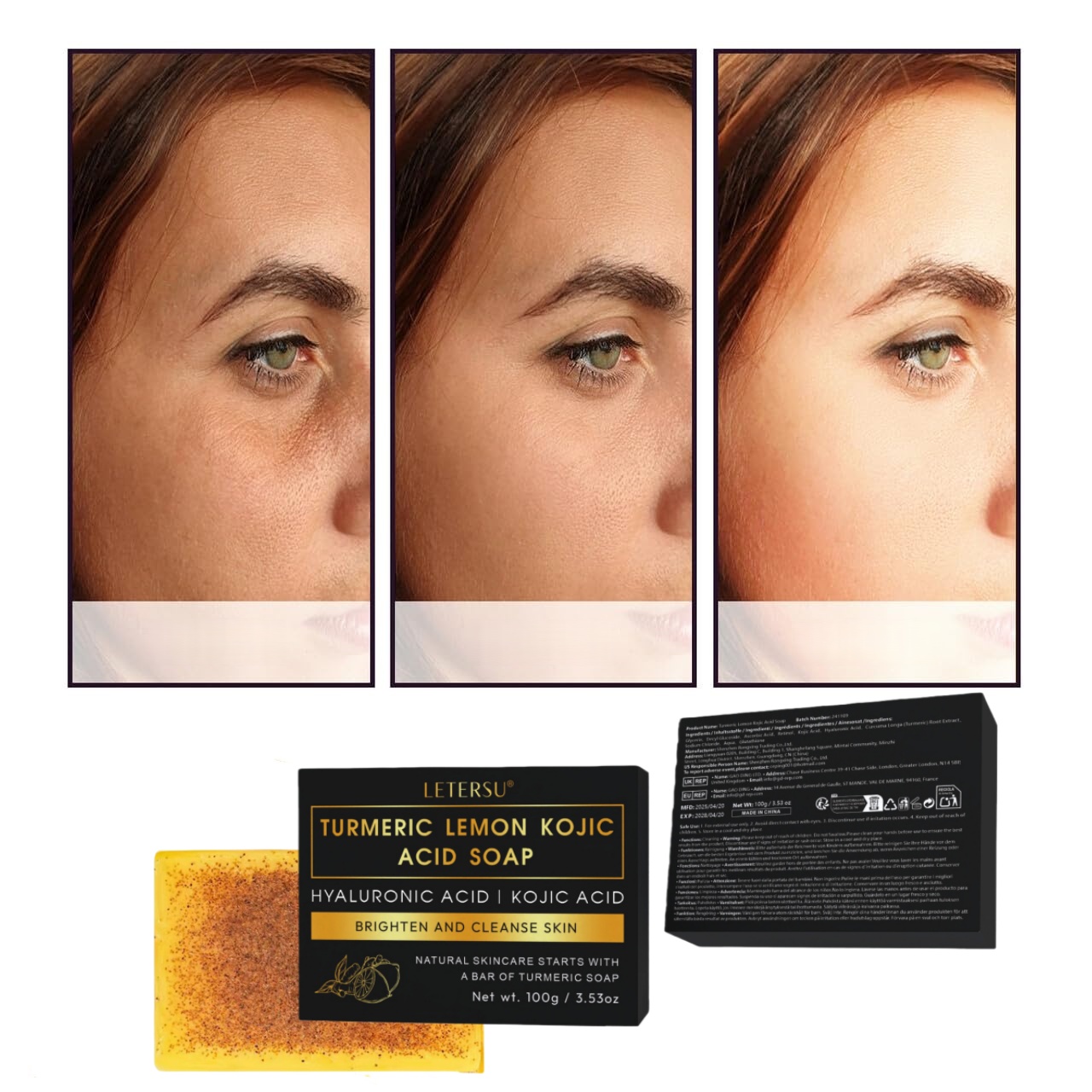 Turmeric Lemon Kojic Acid Soap – Kojic Acid Soap recenzja i cena