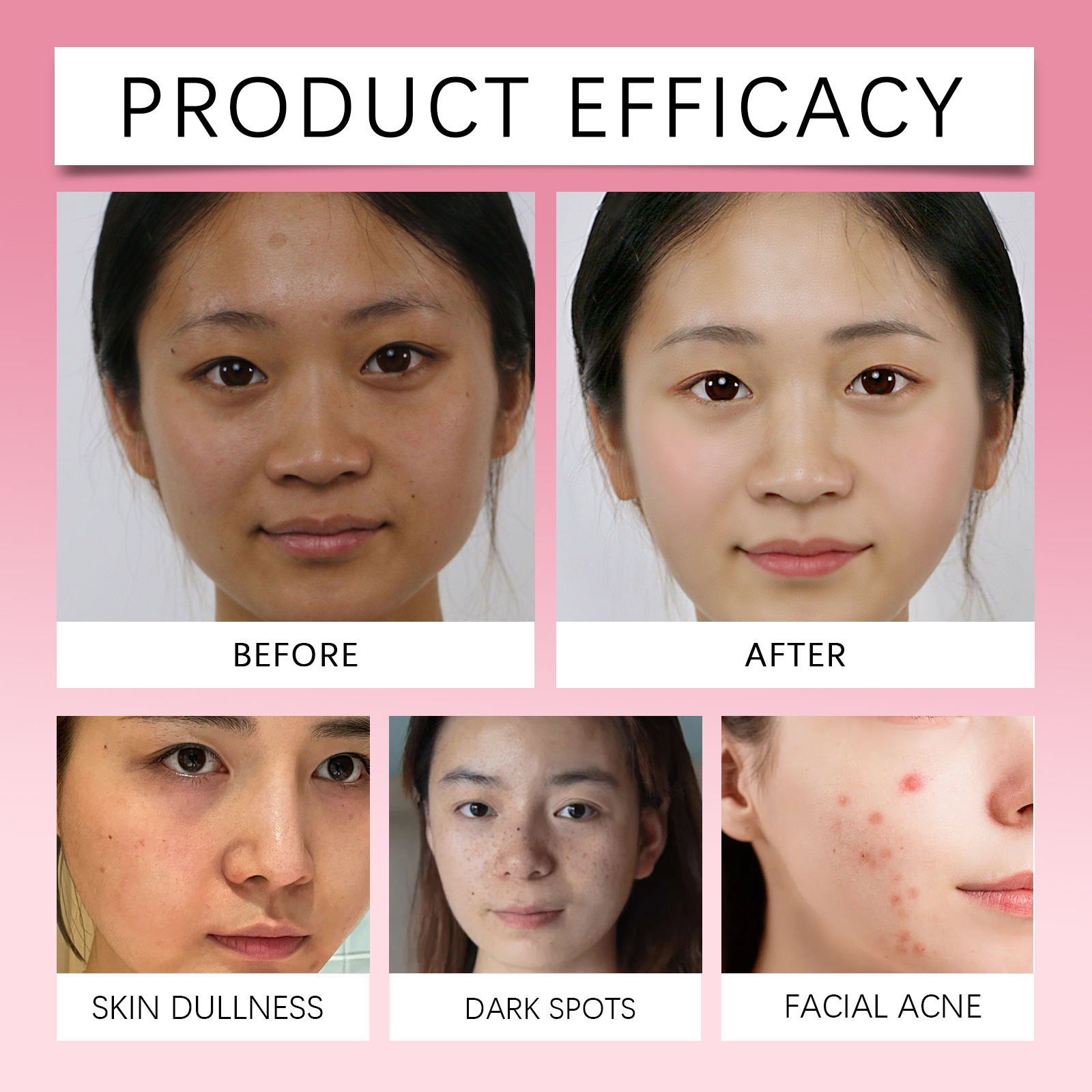Kojic Acid Turmeric Facial Pad – Kojic Acid Soap recenzja i cena