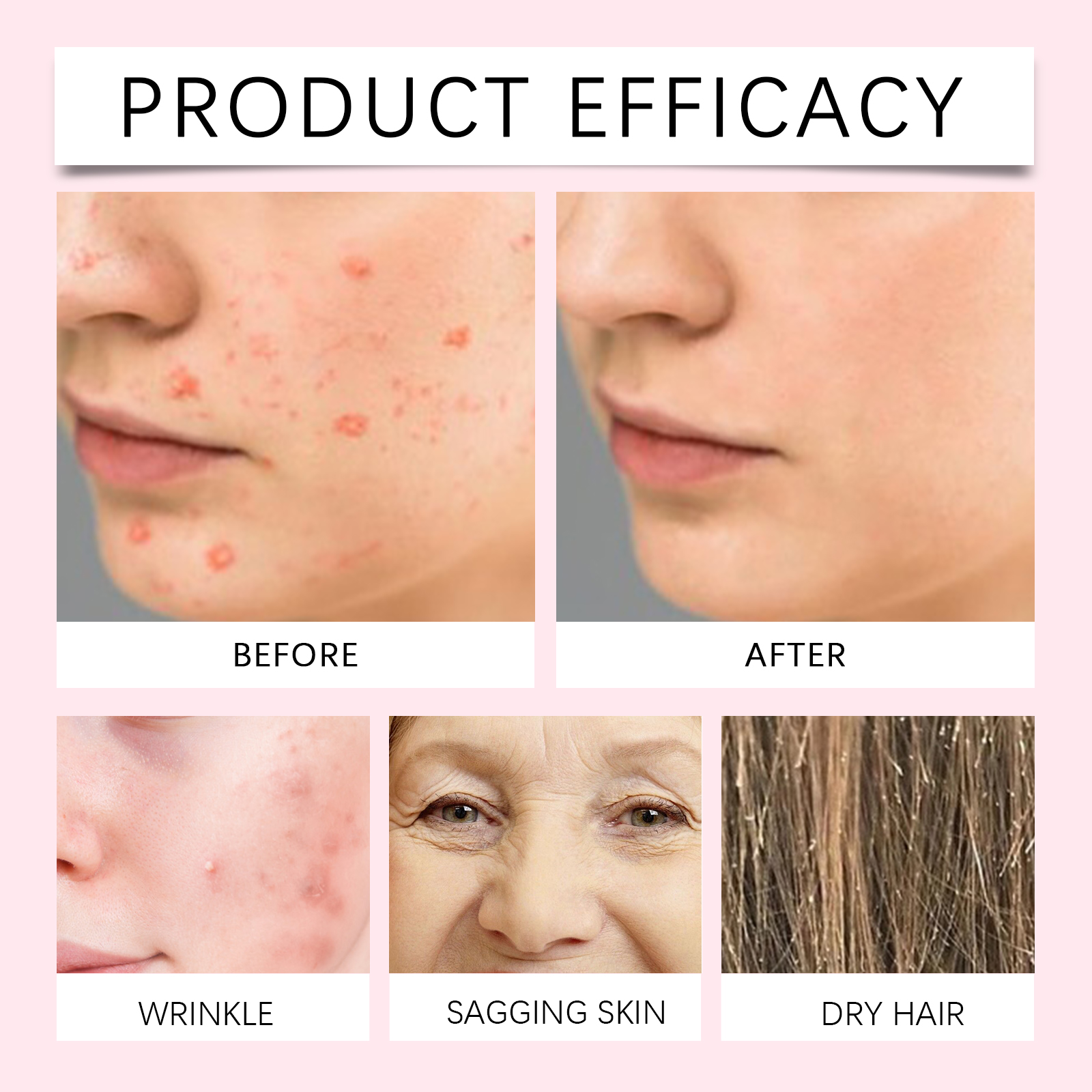 30ml Rosehip Oil For Face Fade – Face Oil Rosehip recenzja i cena