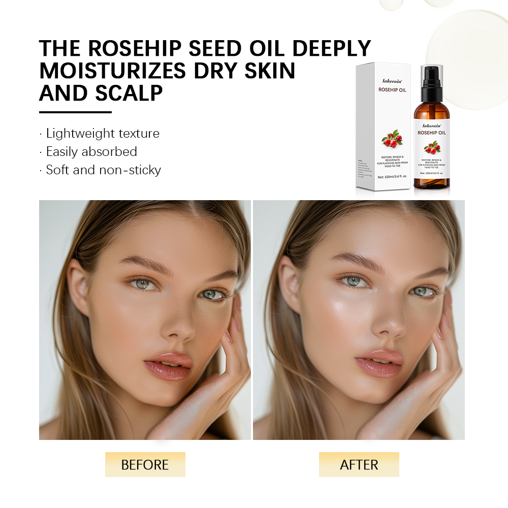 100ml Multifunction Moisturize – Face Oil Rosehip recenzja i cena