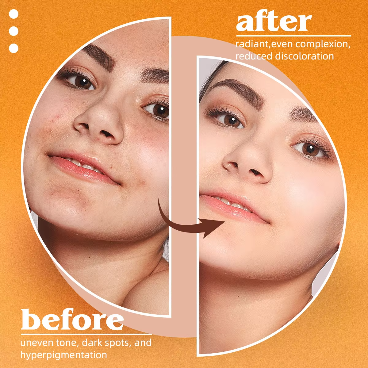 Kojic Acid Natural Papaya Soap – Kojic Acid Soap recenzja i cena