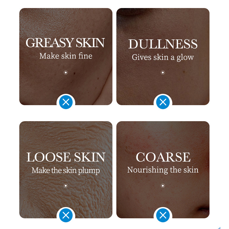 5pcs SADOER Ice Masks for Face – Bentonite Clay Mask recenzja i cena
